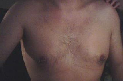 heimlich nackt gefilmt, male exhibitionist